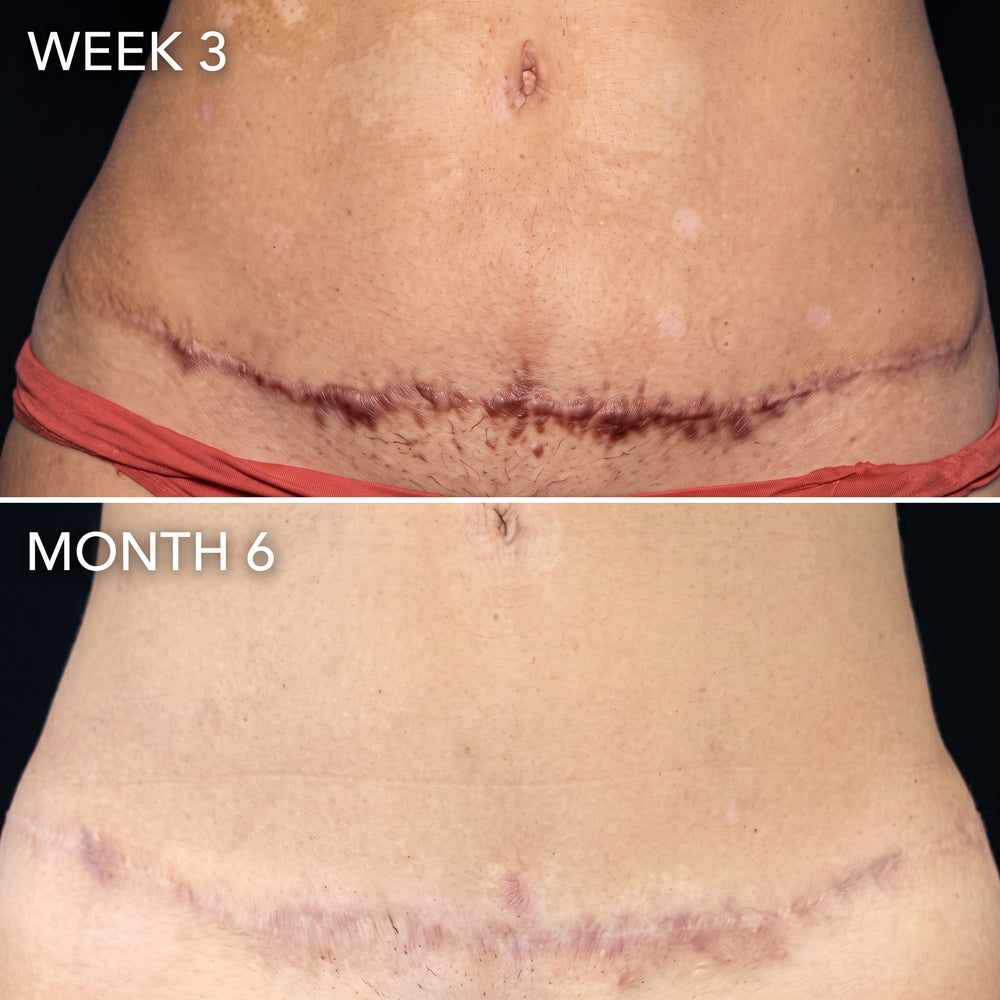 6.) Results That Compound Week After Week