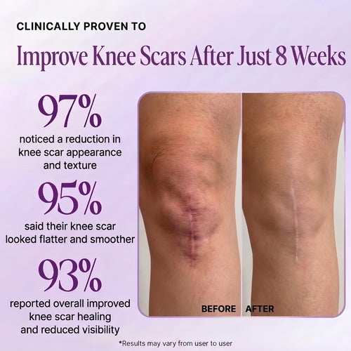 Regenscar Advanced Scar Treatment Knee Scars