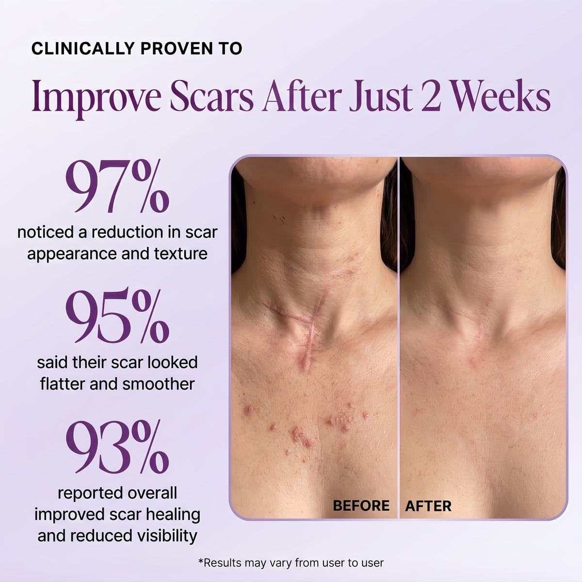 Regenscar Advanced Scar Treatment
