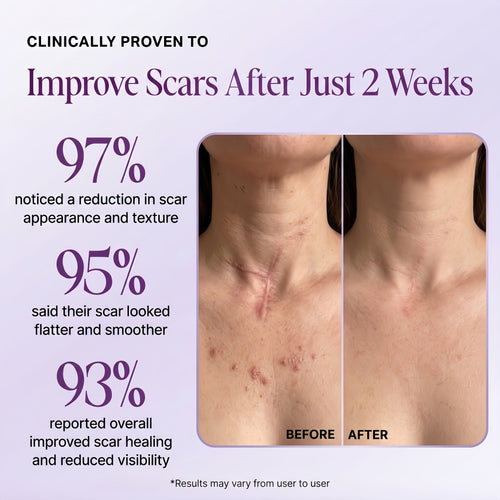 Regenscar Advanced Scar Treatment
