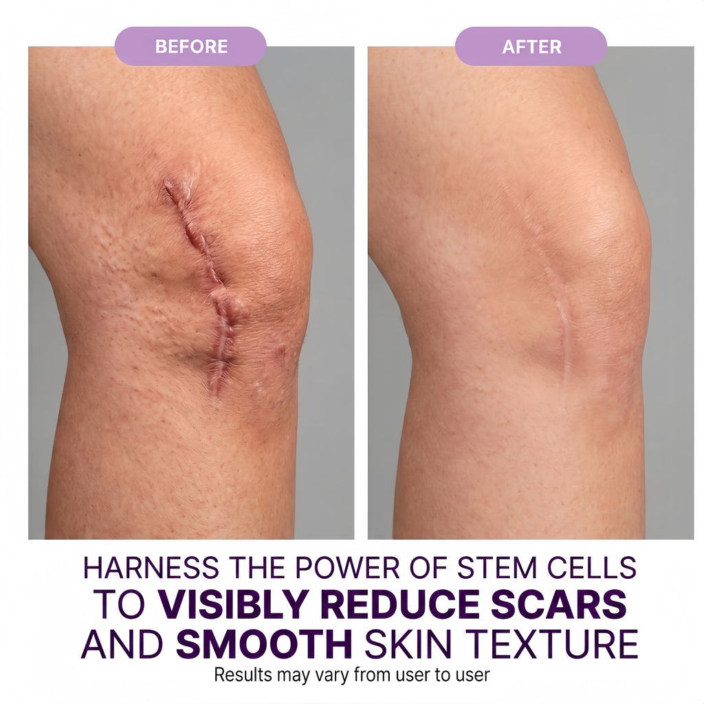 Regenscar Advanced Scar Treatment