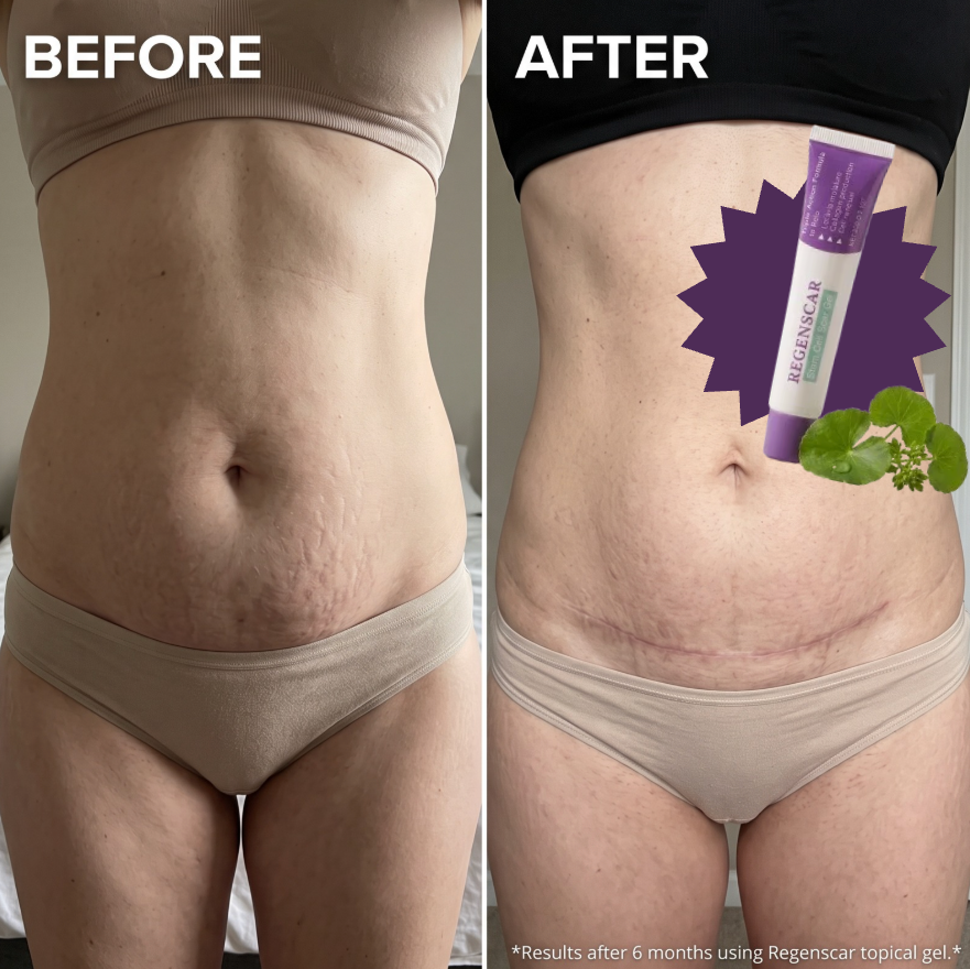1.) Powered by Centella Asiatica Stem Cell Technology